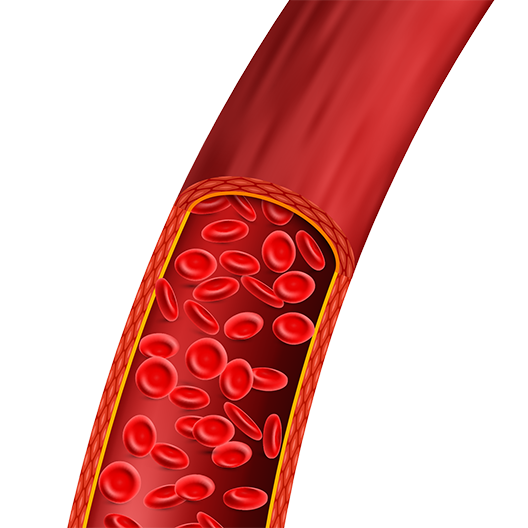 wound Support