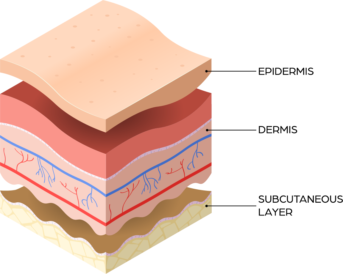 wound Support